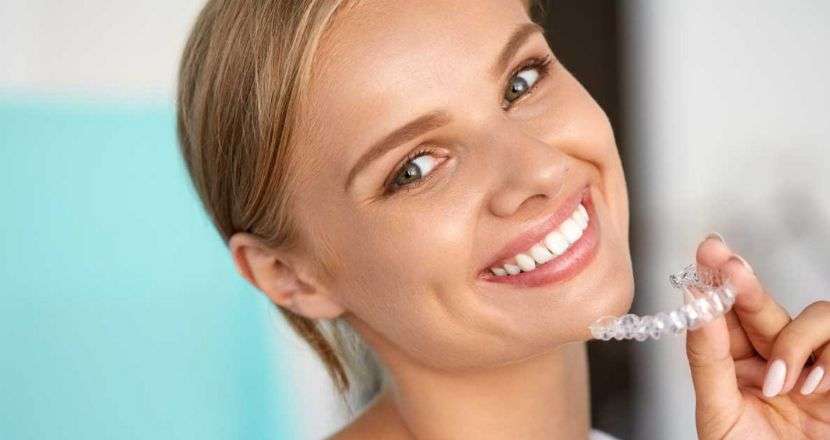 Apparecchio per denti trasparente