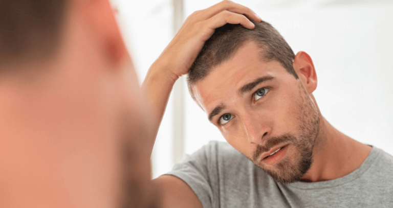 Treatment Options for Psoriasis