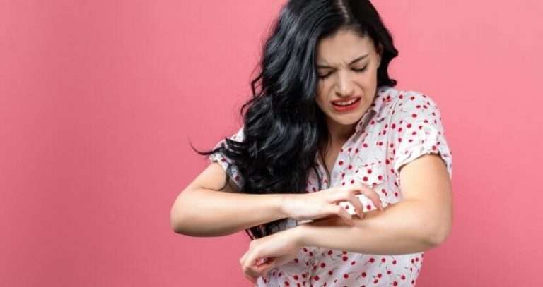 5 suggerimenti per gestire l'eczema meglio