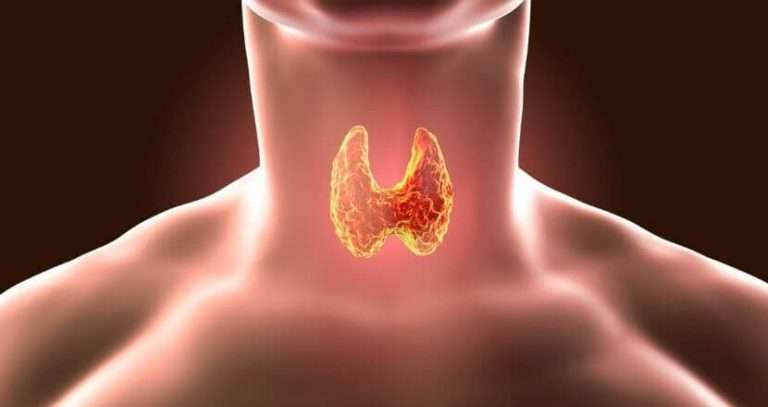 7 Worst Foods For Thyroid Disease