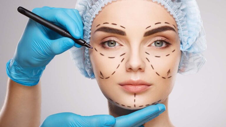 plastic-surgery